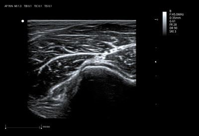 elbow joint_