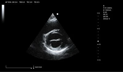 Cardiac LV Short Axis(001)