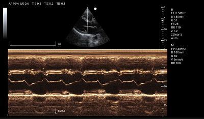 Cardiac M Mode(001)